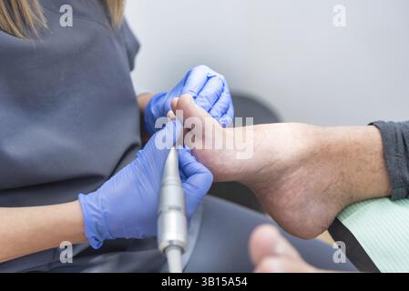 Podiatrist wearing blue gloves provides foot care using specialized tools, focusing on patient comfort and precision in a clinical setting Stock Photo