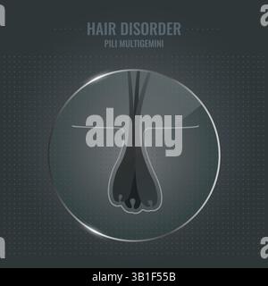 Hair disorder, conceptual illustration Stock Photo - Alamy