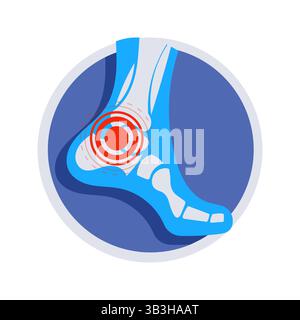 X ray showing ankle pain and inflammation inside a circle Stock Vector