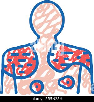 psoriasis skin disease icon doodle illustration Stock Vector Image ...