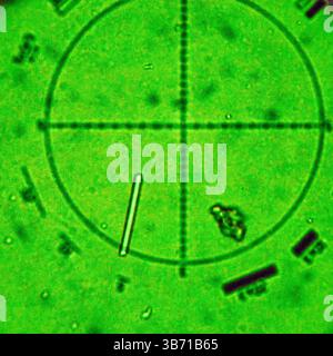 view of one asbestos fiber  using PCM analysis Stock Photo