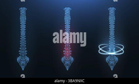 Polygonal vector illustration of a human spine. Image of a healthy, sick and recovering spine Stock Photo