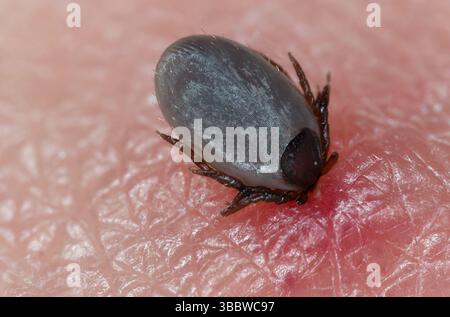 A tick that feeds on human skin. Blushing and redness. Details of the arachnid's body, hair, wrinkles on the surface, perfectly visible. Stock Photo