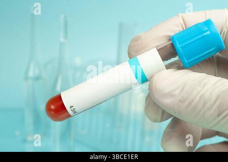 close up hand of a medical professional holding a blood test tube with empty mock up label on blue background, biochemical composition of the patient' Stock Photo