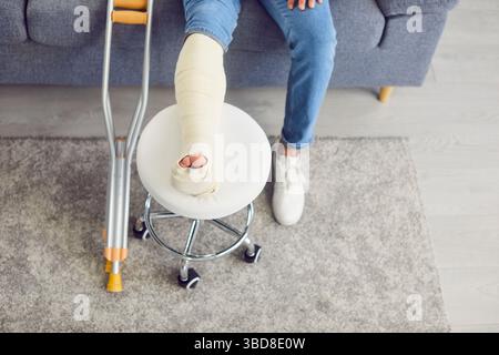 Close Up Of Man Broken Bandaged Leg During Rehabilitation Stock Photo