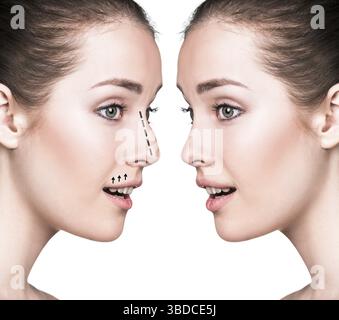 Comparative portrait of female face, before and after plastic surgery of the nose Stock Photo