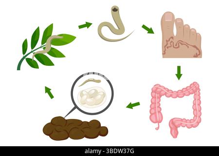 Infographic illustrating the hookworm life cycle, detailing infection stages from larvae on a leaf to skin penetration, intestinal growth, and egg rel Stock Vector