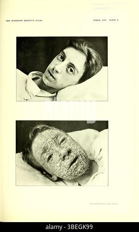 1901 photograph by Dr. Allan Warner showing two 13-year-old boys ...