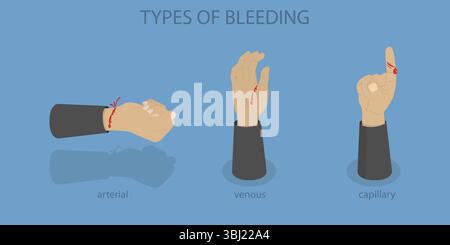 Types Of Accident Stock Photo - Alamy