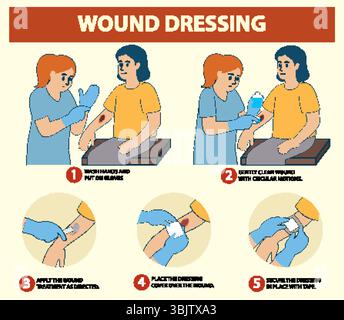 Illustration showing a five-step process for proper wound dressing with ...