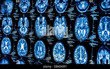 A group of CAT scans of the human brain closeup Stock Photo