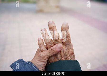 Close-up of Arthritic Hands in an Older Woman Stock Photo