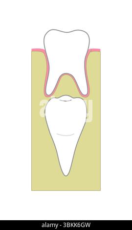 Secondary and primary teeth anatomy. Child and adult jaw illustration ...