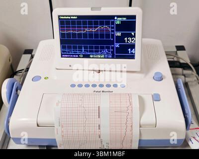 Cardiotocograph recording fetal heart rate and uterine contractions ...