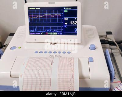 Cardiotocography device placed on mother's abdomen recording the fetal ...
