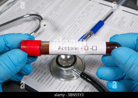 Blood sample testing positive for acetone, held by scientist wearing blue gloves, with stethoscope and medical forms in background Stock Photo