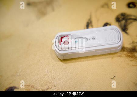 A veterinary rapid test kit lies on a textured surface, displaying a blood sample for analysis. This tool is vital for quick disease detection in vete Stock Photo