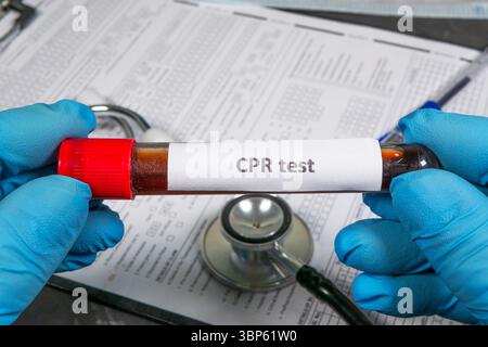 Gloved hands holding cpr blood test tube, with stethoscope and medical forms in background, emphasizing healthcare and diagnostics Stock Photo