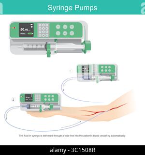 Syringe Pumps for Medical Fluid Delivery Stock Vector