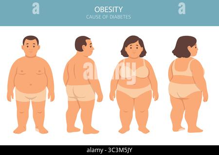 Flat vector illustration of weight loss concept. Before and after body transformation of overweight man and woman. Obese male and female characters sh Stock Vector
