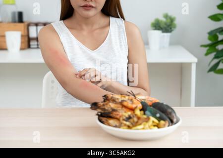 food allergies, women have reactions itching and redness after eating ...