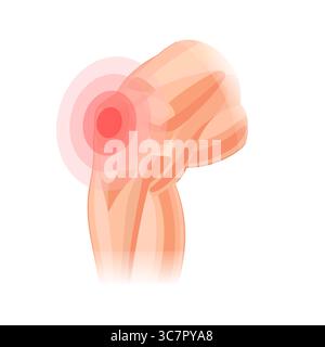 Human knee hurts. Pain in the knee. Arthritis. Human anatomy. Vector illustration isolated on white background Stock Vector
