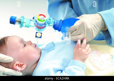 Model released. Infant intubated by doctor. Stock Photo