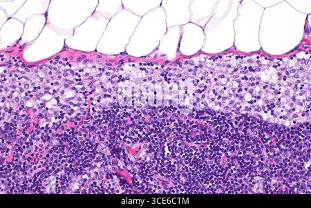 Lymph node macrophages, light micrograph Stock Photo - Alamy