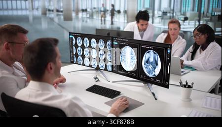 A MRI brain scans of a patient with Multiple Sclerosis Stock Photo - Alamy