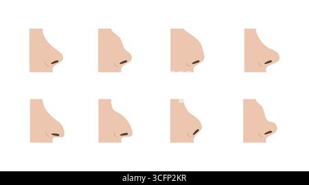 Featuring eight diverse nose profiles, illustrating various shapes and sizes, highlighting options for rhinoplasty and guiding patients in cosmetic su Stock Vector