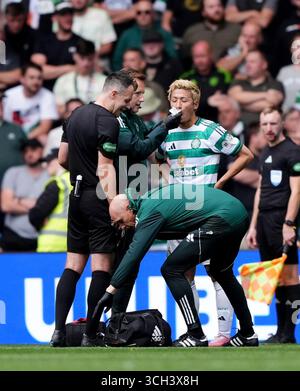 Celtic's Daizen Maeda receives treatment for a head injury after ...