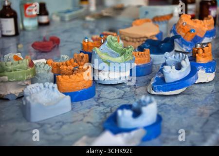 The plaster model of the jaws. Dental prosthesis, dentures, prosthetics work. Dental technician in process of making dentures. teeth putty plaster mol Stock Photo