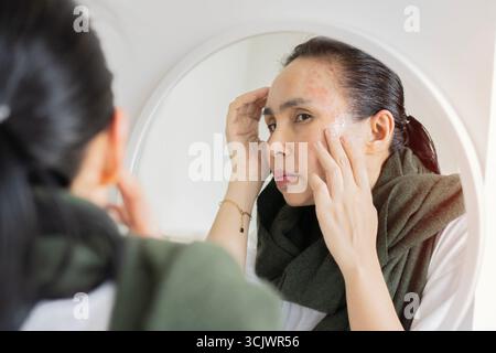Suffering from allergy. Close-up adult Asian woman with problem skin looking into mirror. Beauty care concept. Stock Photo
