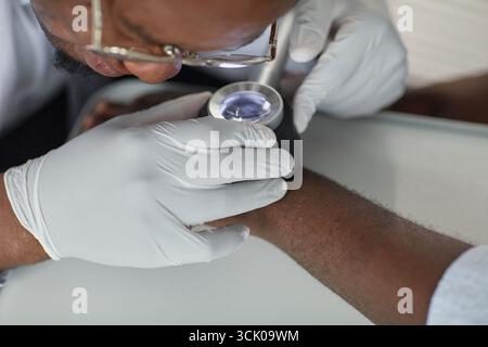 Middle Aged Black Man Examining Arm of Young Black Man Using Dermatoscope Stock Photo