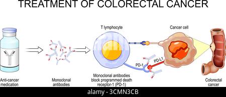 Cancer therapy and Monoclonal antibodies. Vector illustration. Medical ...