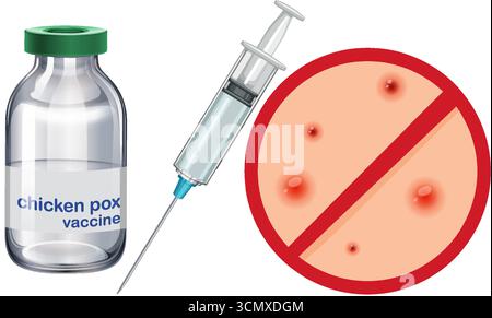 Vector illustration of chickenpox vaccine vial, syringe, and prohibition sign over rash, flat style. Stock Vector