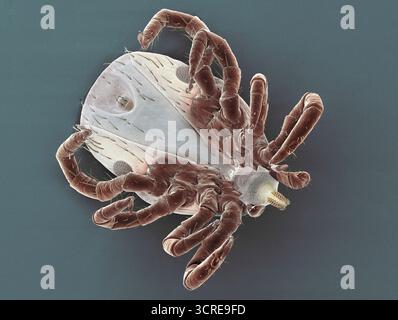 Coloured scanning electron micrograph (SEM) of a castor bean tick (Ixodes ricinus). This blood-sucking parasitic arachnid can transmit both viral and bacterial pathogens. It is the primary vector of Lyme disease in Europe, a bacterial infection that can cause rashes, fever, joint pain and neurological complications. The castor bean tick can also transmit tick-borne encephalitis, a viral infection that may cause fever, headache and, in severe cases, inflammation of the brain and nervous system. Stock Photo