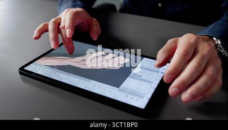 Innovative Biomedical Engineer Designs Prosthetic Arm Using Digital 3D Cad Stock Photo