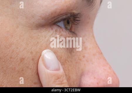 Close up of Womans Eye with Finger Highlighting Signs of Aging Stock Photo
