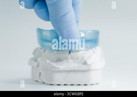 Close-up of a gloved hand placing a transparent blue dental mouthguard onto a white plaster model of human teeth. Stock Photo
