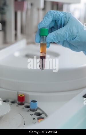 Female biochemistry lab researcher holding test tubes with blood samples and monitoring modern automated chemical analyzer workflow on the screen. Stock Photo