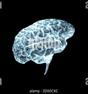X-ray image of a human brain 3D illustration radiograph of a human brain Stock Photo