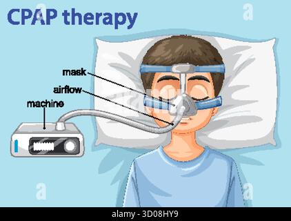 Vector illustration of child lying in bed with CPAP mask and airflow machine, labeled parts Stock Vector