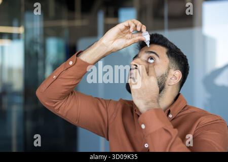 Man using an eye dropper, gently pulling down his lower eyelid and looking up, administering medicine to relieve symptoms of dry eyes, irritation, and improving eye health in an office environment Stock Photo
