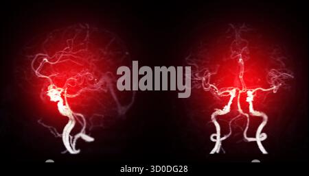 CTA Brain Vascular Imaging , highlights a detailed 3D CTA scan of the ...