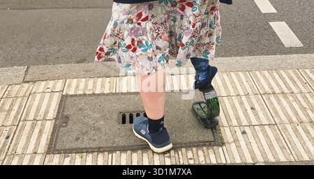 Berlin, Germany - June 02, 2025: unrecognizable Woman with prosthetic limb is walking on urban street wearing a floral dress. Stock Photo