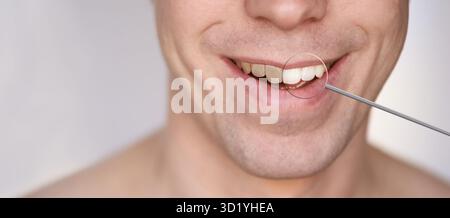 Men smile. Male smiling person. Whitening oral care concept. Teeth before and after. Laughing mounth. Yellow to white color Stock Photo