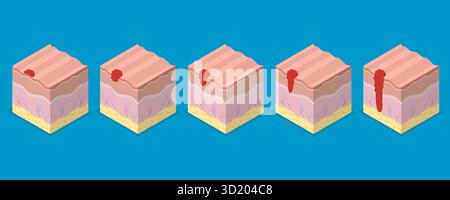 Melanoma cell a type of skin cancer closeup view 3d illustration Stock ...