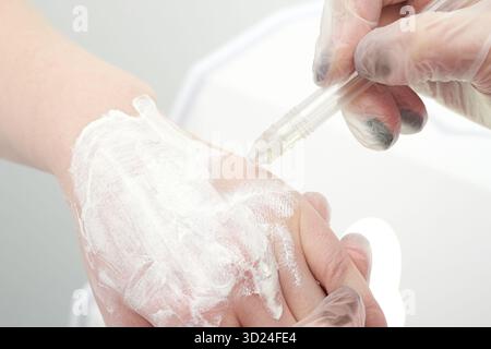 Gloved hands applying skincare cream on caucasian adult's hand with precision Stock Photo