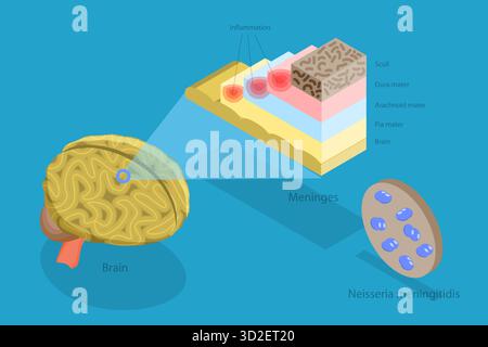 3D Isometric Flat Conceptual Illustration of Meningitis, Human Brain and Meningococcal Bacteria 3D Isometric Flat Conceptual Illustration of Meningitis, Human Brain and Meningococcal Bacteria Stock Photo